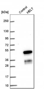 Anti-HELT antibody produced in rabbit HPA036189-100UL