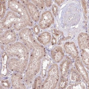 Anti-HELT antibody produced in rabbit HPA036189-100UL