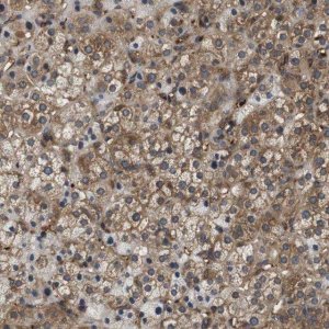 Anti-HERPUD2 antibody produced in rabbit 