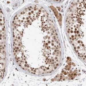 Anti-HESX1 antibody produced in rabbit 