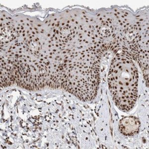 Anti-HESX1 antibody produced in rabbit 