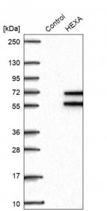 Anti-HEXA antibody produced in rabbit 