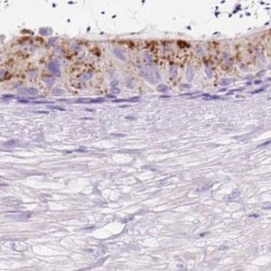 Anti-HEXB antibody produced in rabbit 