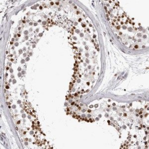 Anti-HEXIM2 antibody produced in rabbit 