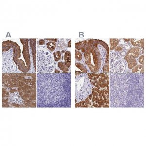 Anti-HGD antibody produced in rabbit HPA052359-100UL