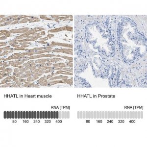 Anti-HHATL antibody produced in rabbit 
