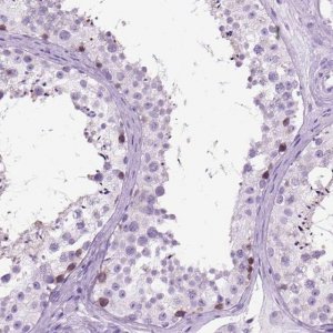 Anti-HHIPL2 antibody produced in rabbit 