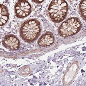 Anti-HHLA2 antibody produced in rabbit 