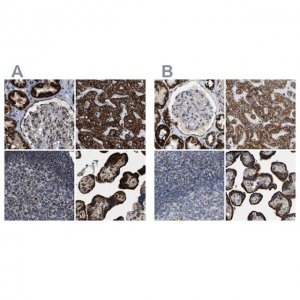 Anti-HIBADH antibody produced in rabbit HPA021002-100UL