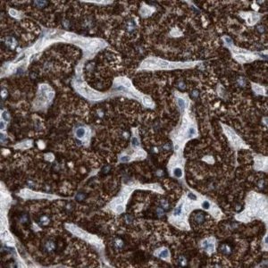 Anti-HIBADH antibody produced in rabbit HPA021002-100UL