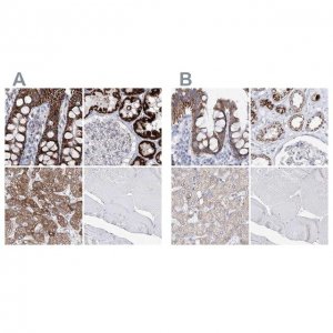 Anti-HIBCH antibody produced in rabbit 