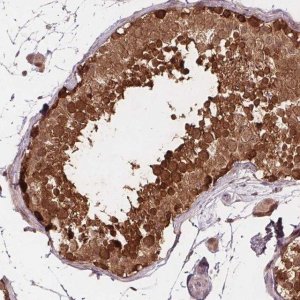 Anti-HIF1AN antibody produced in rabbit 