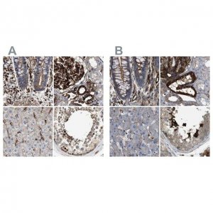 Anti-HIP1 antibody produced in rabbit 
