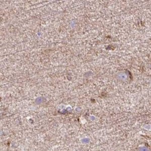Anti-HIP1R antibody produced in rabbit 