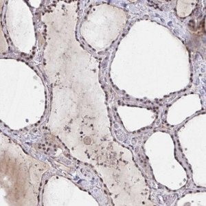 Anti-HIRA antibody produced in rabbit 