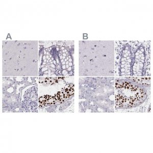 Anti-HIST1H1T antibody produced in rabbit 