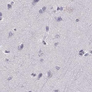 Anti-HIST1H1T antibody produced in rabbit 