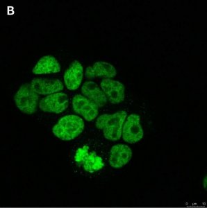 Anti-Histone H3.3 G34R Antibody, clone 2L10 ZooMAb Rabbit Monoclonal 
