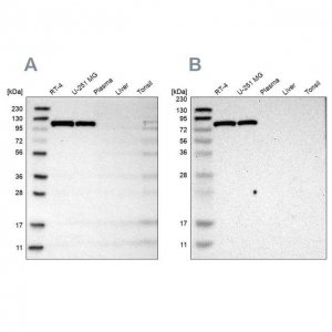 Anti-HK1 antibody produced in rabbit 