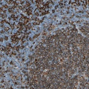 Anti-HLA-DPB1 antibody produced in rabbit 