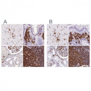 Anti-HLA-DRA antibody produced in rabbit 