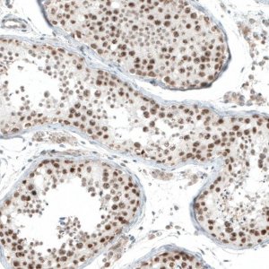Anti-HLTF antibody produced in rabbit 