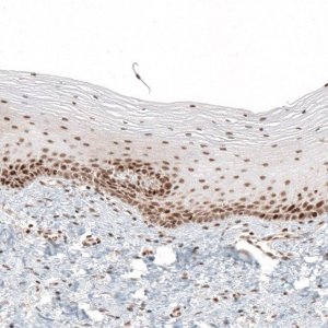 Anti-HLTF antibody produced in rabbit 
