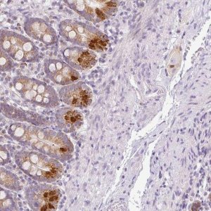 Anti-HMCN2 antibody produced in rabbit 