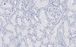 Anti-HMGB1 Antibody, clone 3K6, ZooMAb Rabbit Monoclonal 