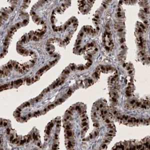 Anti-HMGN3 antibody produced in rabbit 