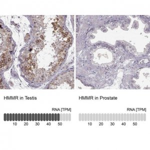 Anti-HMMR antibody produced in rabbit 
