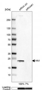 Anti-HN1 antibody produced in rabbit HPA059729-100UL