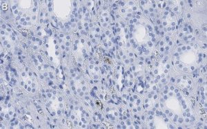 Anti-HNF-1 Antibody, clone 1M22 ZooMAb Rabbit Monoclonal 