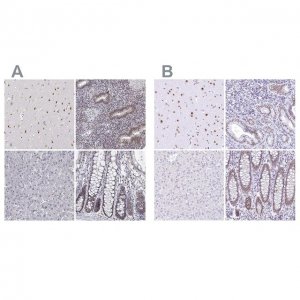 Anti-HNRNPA0 antibody produced in rabbit HPA059404-100UL