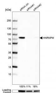 Anti-HNRNPM antibody produced in rabbit HPA024344-100UL