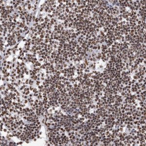 Anti-HNRNPM antibody produced in rabbit HPA024344-100UL