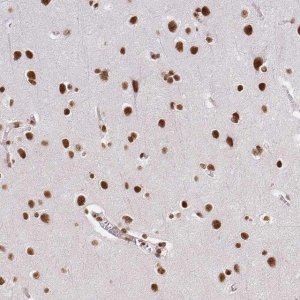 Anti-HNRNPU antibody produced in rabbit HPA058707-100UL