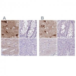 Anti-HOMER1 antibody produced in rabbit 
