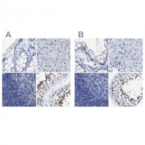 Anti-HOOK1 antibody produced in rabbit HPA018820-100UL