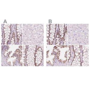 Anti-HOXB13 antibody produced in rabbit 