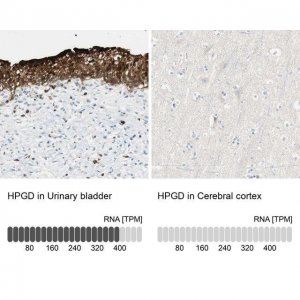 Anti-HPGD antibody produced in rabbit 