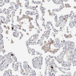 Anti-HPGDS antibody produced in rabbit 