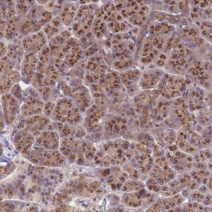Anti-HPS3 antibody produced in rabbit 