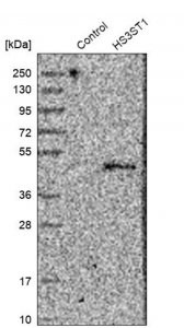 Anti-HS3ST1 antibody produced in rabbit HPA002237-100UL