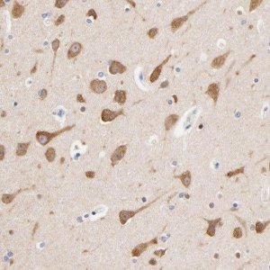 Anti-HS3ST1 antibody produced in rabbit HPA002237-100UL