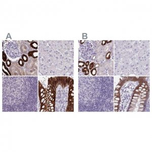 Anti-HSD11B2 antibody produced in rabbit 