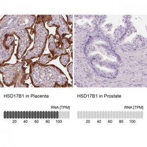 Anti-HSD17B1 antibody produced in rabbit 