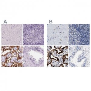 Anti-HSD17B1 antibody produced in rabbit 