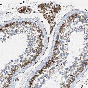 Anti-HSD17B12 antibody produced in rabbit 