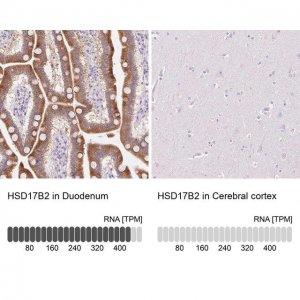 Anti-HSD17B2 antibody produced in rabbit 